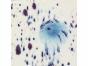 S2701 Peacock Eye